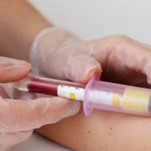 BLOOD TEST